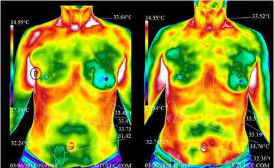 La mise à la terre améliorerait la circulation faciale et abdominale - chargeurterre